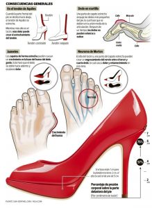 Infografía de los problemas del uso de zapatos de tacón