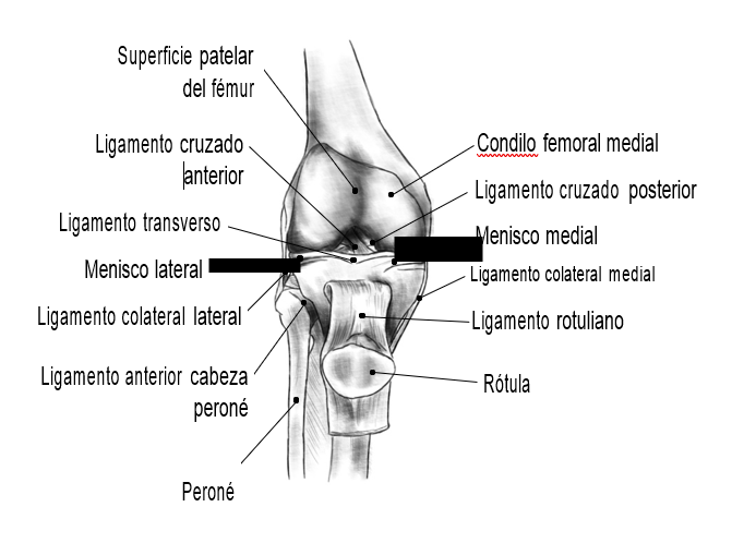 síndrome femoropateral