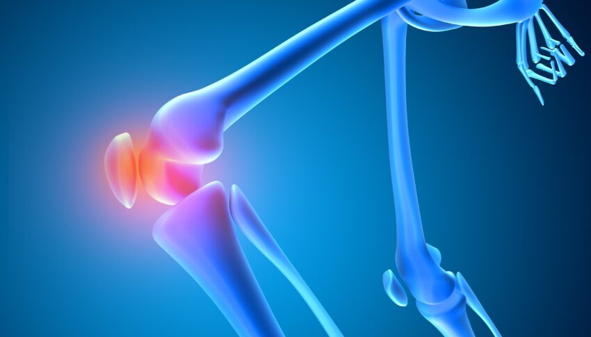 3D render of a medical image of a skeleton with knee bone highlighted